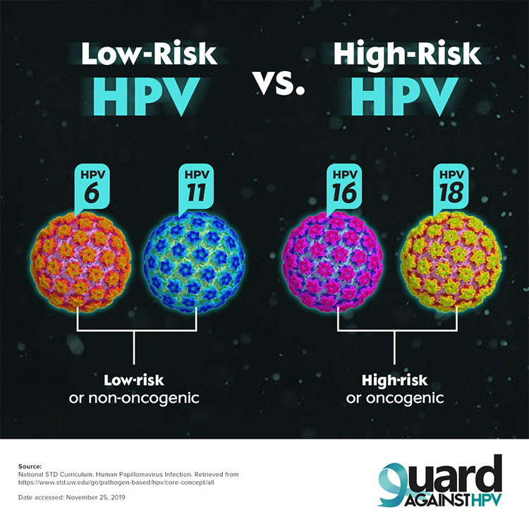 Project Output Image